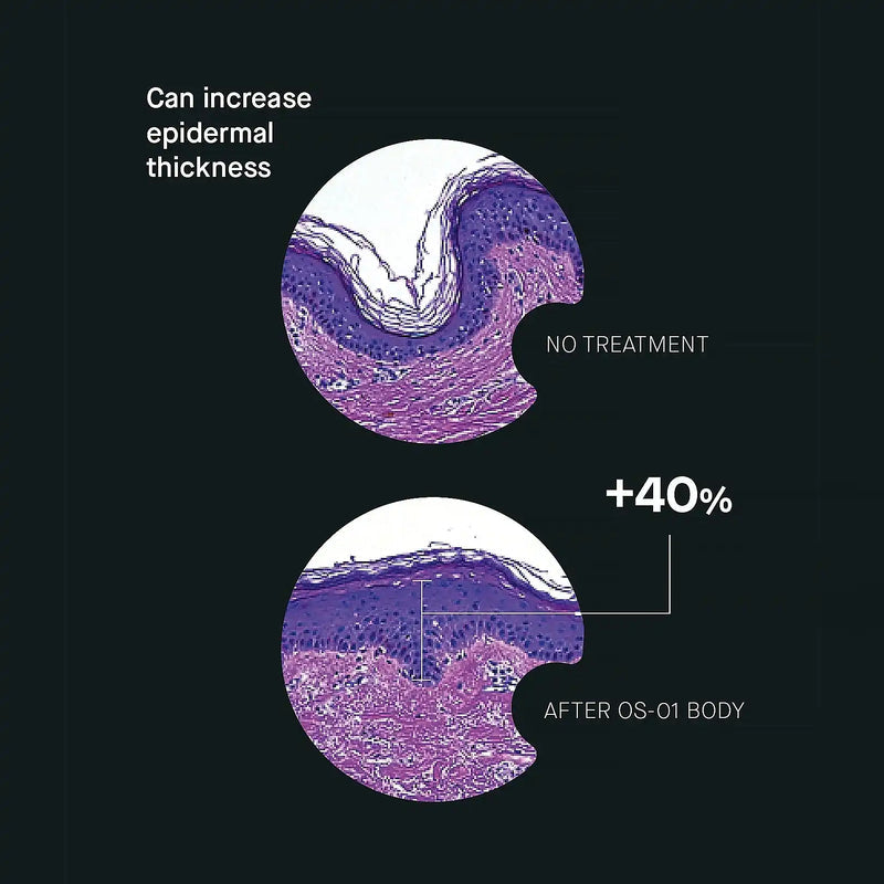 OS-01 BODY Topical Supplement